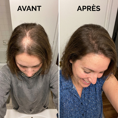 Gouttes de Soutien Thyroïdien